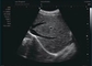 USG Dopplera w ciąży Domowa sonda USG Dopplera Częstotliwość 12MHz