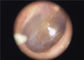 Dostępne jednorazowe Earmuff Dostępne Medyczne przenośne Otoskop Endoskopowe Dla gardła oczu
