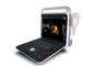 15-calowy kolorowy ultrasonograf Doppler Maszyna o wysokiej rozdzielczości ekran LCD