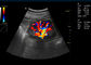 Przenośny, kolorowy, dopplerowski 15-calowy LED cyfrowy system diagnostyki ultradźwiękowej